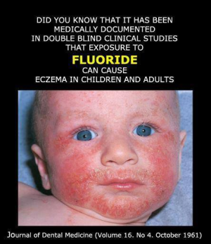 http://www.fluoride-class-action.com/wp-content/uploads/fluoride-can-cause-eczema-in-babies-e1387357131141.png